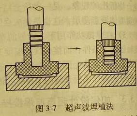什么是超声波埋植法?